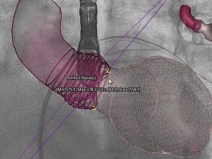 Diagnose Fluoroscopy